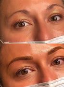 Image result for X On Eyebrow