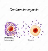 Image result for Gardnerella Vaginalis Morfologia
