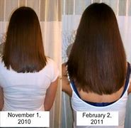 Image result for Biotin Hair Growth Before and After
