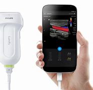 Image result for Ultrasound for My Phone