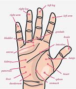 Image result for Hand Acupuncture