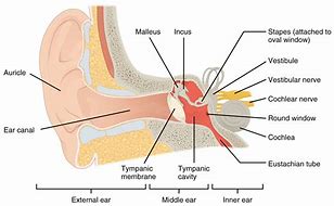 Image result for Medical Ear Buds