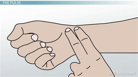 Image result for What Is Pulse Deficit