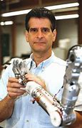Image result for Dean Kamen Deka Arm