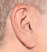Image result for Smallest Inner Ear Hearing Aids