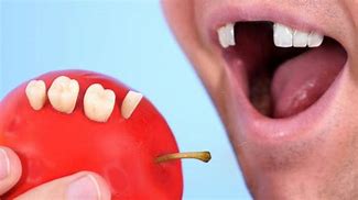 Image result for Apple Tooth Rotten