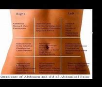 Image result for abdominal