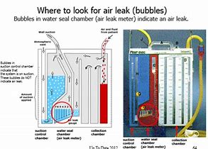 Image result for Tidaling vs Air Leak