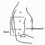 Image result for Large Intestine Acupuncture Points