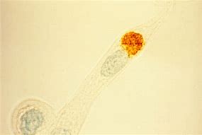 Image result for Chlamydia Trachomatis Elementary Bodies