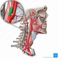 Image result for Carotid Body and Sinus