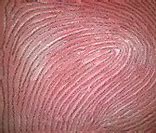 Image result for Fingerprint Blown Up