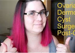 Image result for Dermoid Cyst during Pregnancy