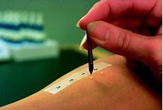 ricorrere al test dentrificio per i test allergologici ricorrere al test dentrificio per i test allergologici