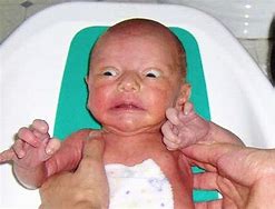 Image result for Ugly Baby Eyes