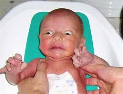 Image result for Ugly Baby Erobb221