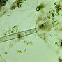Image result for fiyoplancton