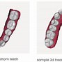 Image result for My Byte Aligners Haven't Came