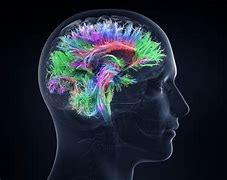 Image result for Neuroplasticity Images