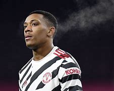 Image result for Anthony Martial Injury