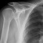 Image result for What Is an Angiogram On Shoulder