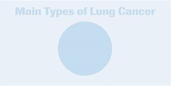 Image result for Non Calcified Lung Nodule