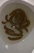 Image result for Hook-Shaped Poop