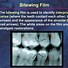Image result for Lanex Screen Radiography