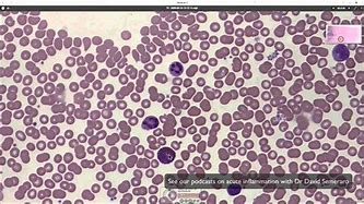 Image result for What Does Blood Look Like at 8:00 Magnification