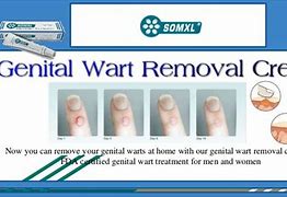 Image result for Genital Wart Removal