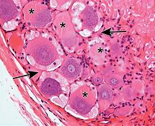 Image result for Satellite Cells Ganglia Histology