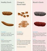 Image result for Types of Poop Chart Meaning