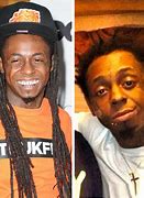 Image result for Lil Wayne Hairline