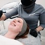 Image result for Cryotherapy Before and After Skin Cancer