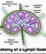 Image result for 2 Cm Lymph Node