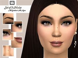 Image result for Nevus Sims 4