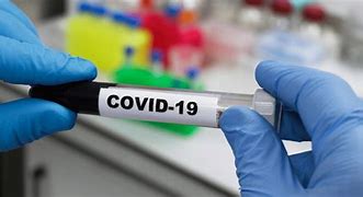 Image result for Covid 19 PCR Test