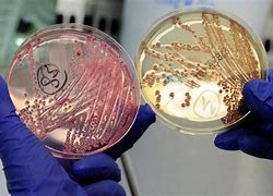 Image result for bacteriano