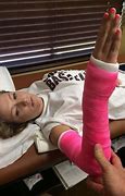 Image result for Picture of an Arm Cast without a Hand