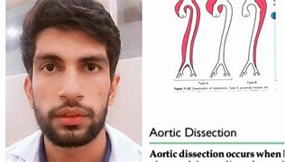 Image result for Blunt Dissection