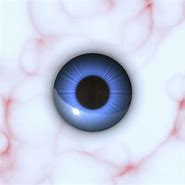 Image result for Operculated Hole Retina