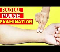 Image result for Radial Pulse