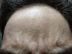 Image result for Grainy Texture Skin