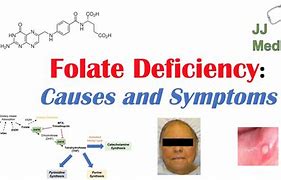 Image result for Folic Acid Deficiency Signs in Babies