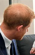 Image result for Prince Harry's Hair