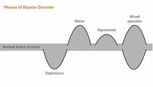 Image result for Bipolar Brain Waves