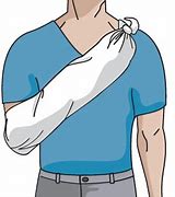 Image result for Picture of Arm Sling Clip Art as First Aid