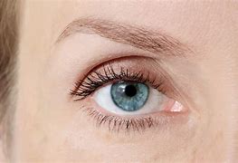 Image result for Blue Eye Surgery
