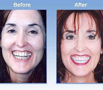 Image result for Types of Dental Cosmetic Surgery
