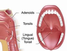 Image result for adenopzt�a